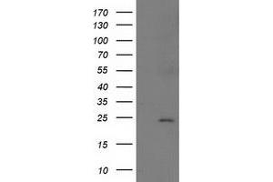 Western Blotting (WB) image for anti-Suppressor of Cytokine Signaling 3 (SOCS3) antibody (ABIN1501057) (SOCS3 antibody)