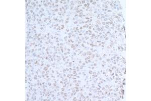 Immunohistochemistry (IHC) image for anti-Ubiquitin Protein Ligase E3 Component N-Recognin 5 (UBR5) (AA 600-650) antibody (ABIN7454646)
