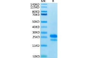 Human VEGF165 on Tris-Bis PAGE under reduced condition. (VEGF 165 Protein)