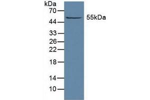 Detection of ALDH1A1 in Rat Liver Tissue using Polyclonal Antibody to Aldehyde Dehydrogenase 1 Family, Member A1 (ALDH1A1) (ALDH1A1 antibody  (AA 2-501))