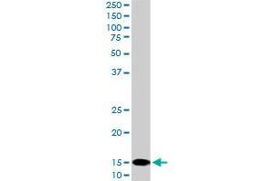 UBE2D2 monoclonal antibody (M02), clone 4A1. (UBE2D2 antibody  (AA 1-94))