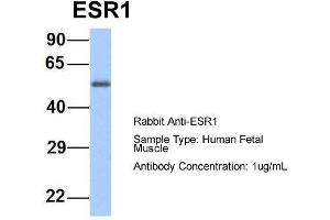 Host:  Rabbit  Target Name:  ESR1  Sample Type:  Human Fetal Muscle  Antibody Dilution:  1. (Estrogen Receptor alpha antibody  (Middle Region))