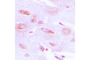 Immunohistochemical analysis of GRK2 (pS29) staining in human brain formalin fixed paraffin embedded tissue section. (GRK2 antibody  (N-Term, pSer29))