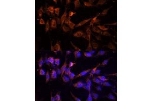 Immunofluorescence analysis of NIH-3T3 cells using YWHAH Polyclonal Antibody (ABIN6131142, ABIN6150348, ABIN6150349 and ABIN6224884) at dilution of 1:100 (40x lens). (14-3-3 eta antibody  (AA 1-246))