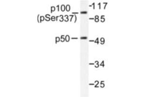 Image no. 1 for anti-Nuclear Factor of kappa Light Polypeptide Gene Enhancer in B-Cells 1 (NFKB1) (pSer337) antibody (ABIN318079) (NFKB1 antibody  (pSer337))