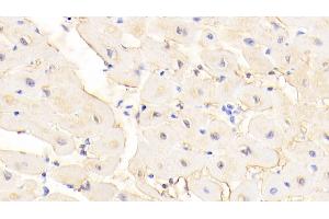 Detection of DMD in Human Cardiac Muscle Tissue using Polyclonal Antibody to Dystrophin (DMD) (Dystrophin antibody  (AA 3048-3328))