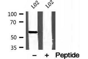 Western blot analysis of extracts of L02 cells, using CYP26B1 antibody. (CYP26B1 antibody  (Internal Region))