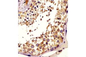(ABIN6243764 and ABIN6578200) staining KISS1 in human testis tissue sections by Immunohistochemistry (IHC-P - paraformaldehyde-fixed, paraffin-embedded sections). (KISS1 antibody  (AA 20-52))