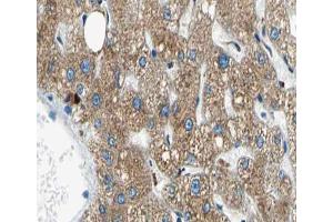 ABIN6266653 at 1/100 staining human liver tissue sections by IHC-P. (NUB1 antibody)