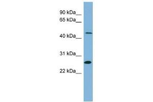 UPB1 antibody used at 1 ug/ml to detect target protein. (UPB1 antibody  (Middle Region))