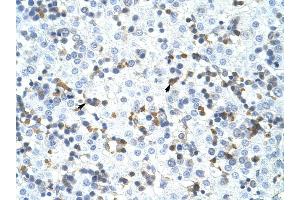 CPSF3 antibody was used for immunohistochemistry at a concentration of 4-8 ug/ml to stain Liver cell (arrows) in Human Liver. (CPSF3 antibody  (C-Term))