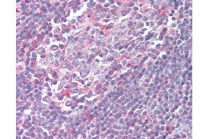 Anti-XCR1 antibody IHC of human tonsil. (XCR1 antibody  (Cytoplasmic Domain))