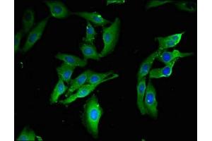 Immunofluorescent analysis of Hela cells using ABIN7172344 at dilution of 1:100 and Alexa Fluor 488-congugated AffiniPure Goat Anti-Rabbit IgG(H+L) (TRAF3IP3 antibody  (AA 74-185))