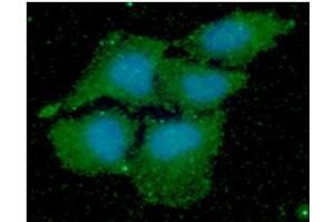 ICC/IF analysis of PPIF in HeLa cells line, stained with DAPI (Blue) for nucleus staining and monoclonal anti-human PPIF antibody (1:100) with goat anti-mouse IgG-Alexa fluor 488 conjugate (Green).