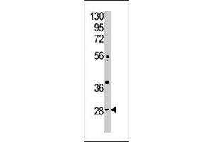 The CA9 polyclonal antibody  is used in Western blot to detect CA9 in Jurkat cell lysate.