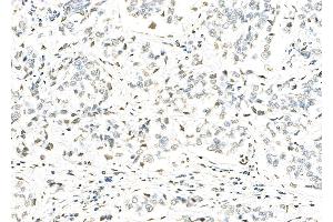 anti-Histone H2A Type 3 (HIST3H2A) antibody