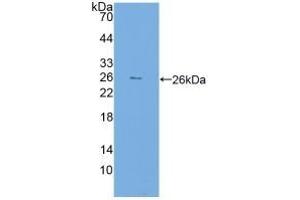 Detection of Recombinant FKBP7, Human using Polyclonal Antibody to FK506 Binding Protein 7 (FKBP7) (FKBP7 antibody  (AA 24-217))