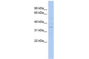 Image no. 1 for anti-Aspartate Dehydrogenase Domain Containing (ASPDH) (AA 71-120) antibody (ABIN6744015) (ASPDH antibody  (AA 71-120))