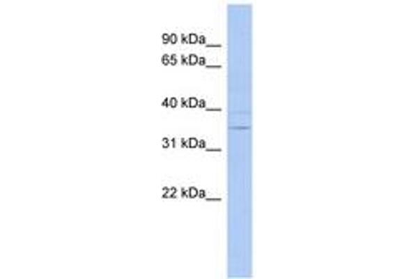 ASPDH antibody  (AA 71-120)