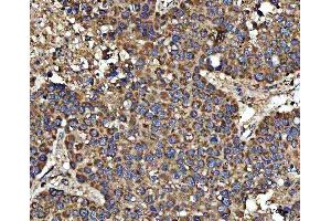 IHC analysis of HSD17B7 using anti-HSD17B7 antibody (ABIN7600174). (HSD17B7 antibody  (AA 16-336))