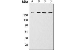 Western blot analysis of mTOR expression in HeLa (A), MCF7 (B), Jurkat (C), A431 (D) whole cell lysates.