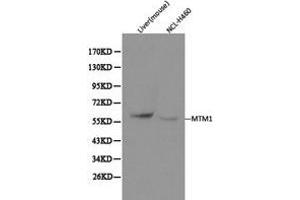 Western Blotting (WB) image for anti-Myotubularin 1 (MTM1) antibody (ABIN1873773)
