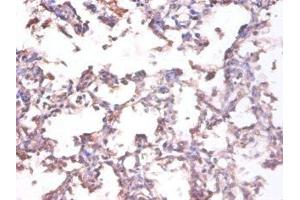 Immunohistochemistry of paraffin-embedded human lung tissue using ABIN7173786 at dilution of 1:100 (LTA antibody  (AA 39-281))