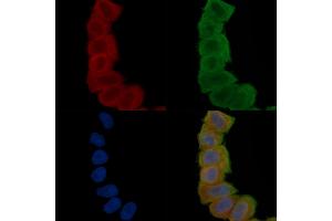 ABIN6265833 and ABIN6277102 staining Hela cells(30 min of UV treatment) by IF/ICC. (UAP1 antibody  (Internal Region))