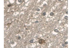 Immunohistochemistry (IHC) image for anti-Aldolase A, Fructose-Bisphosphate (ALDOA) (AA 18-273) antibody (ABIN7440131)