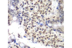 Immunohistochemistry of paraffin-embedded Rat Intestine using U2AF1 Polyclonal Antibody at dilution of 1:200 (40x lens). (U2AF1 antibody)