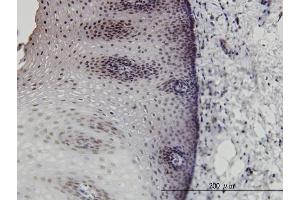 Immunoperoxidase of monoclonal antibody to DLX2 on formalin-fixed paraffin-embedded human esophagus. (DLX2 antibody  (AA 1-110))