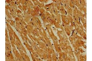 Immunohistochemistry of paraffin-embedded human heart tissue using ABIN7163291 at dilution of 1:100 (PIK3R4 antibody  (Regulatory Subunit 4))