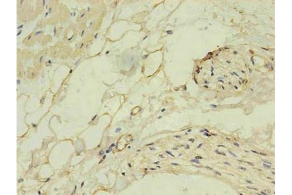 NPPB antibody