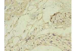 Immunohistochemistry of paraffin-embedded human heart using  in 30 μg/mL dilute concentrations. (NPPB antibody)