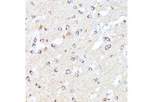 Immunohistochemistry of paraffin-embedded mouse brain using CCDC6 antibody (ABIN7266442) at dilution of 1:100 (40x lens).