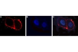 Immunocytochemistry (ICC) image for anti-Luteinizing Hormone/Choriogonadotropin Receptor (LHCGR) (AA 327-340), (Extracellular) antibody (ABIN7043309)