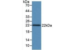 Detection of Recombinant TNFb, Human using Monoclonal Antibody to Tumor Necrosis Factor Beta (TNFb) (LTA antibody  (AA 36-205))