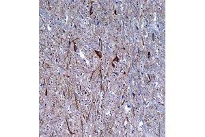 Immunohistochemical staining of formalin-fixed and paraffin-embedded human brain tissue reacted with INA monoclonal antibody  at 1:10-1:50 dilution.