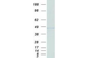 Western Blotting (WB) image for Excision Repair Cross Complementing Polypeptide-1 (ERCC1) (Transcript Variant 1) protein (Myc-DYKDDDDK Tag) (ABIN2720417)