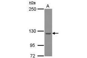 Image no. 2 for anti-WASH Complex Subunit 5 (WASHC5) (C-Term) antibody (ABIN1491792) (Strumpellin antibody  (C-Term))
