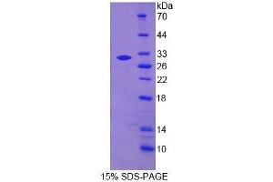 SDS-PAGE analysis of Human MPG Protein.