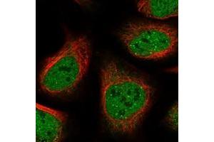 Immunofluorescent staining of human cell line U-2 OS with ANKRD12 polyclonal antibody  at 1-4 ug/mL dilution shows positivity in nucleus but not nucleoli and cytoplasm. (ANKRD12 antibody)