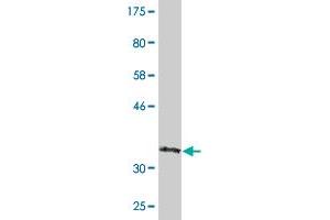 Western Blot detection against Immunogen (36. (CRYBB3 antibody  (AA 112-211))