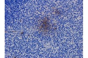 Immunohistochemical staining of rat spleen tissue using anti-CD52 antibody.