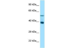WB Suggested Anti-Trim7 Antibody Titration: 1. (TRIM7 antibody  (N-Term))