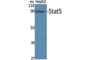 Western Blot (WB) analysis of specific cells using Stat5 Polyclonal Antibody. (STAT5A antibody)
