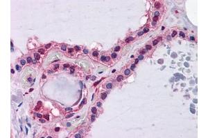 Immunohistochemistry (IHC) image for anti-Hepcidin Antimicrobial Peptide (HAMP) (AA 25-85) antibody (ABIN614727) (Hepcidin antibody  (AA 25-85))