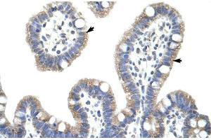 Immunohistochemistry (IHC) image for anti-NF-kappa-B inhibitor beta (NFKBIB) (C-Term) antibody (ABIN2775837)