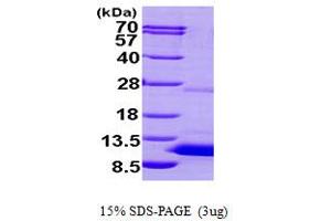 SDS-PAGE (SDS) image for S100 Calcium Binding Protein P (S100P) (AA 1-95) protein (His tag) (ABIN667002) (S100P Protein (AA 1-95) (His tag))