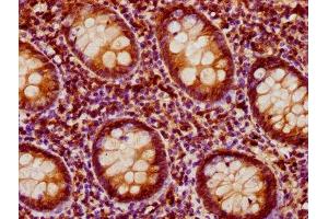 IHC image of ABIN7166598 diluted at 1:200 and staining in paraffin-embedded human appendix tissue performed on a Leica BondTM system. (PEAK1 antibody  (AA 715-881))